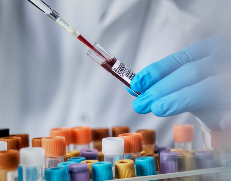 A lab technician drawing blood from a vial