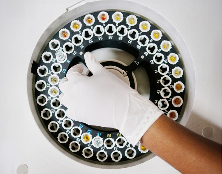 A gloved hand using a centrifuge