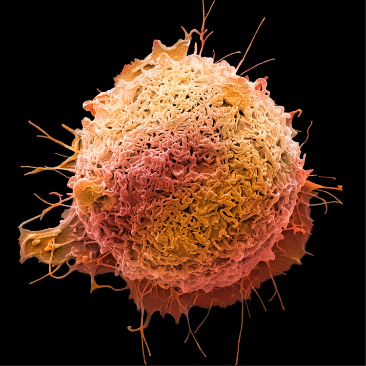 Colorectal cancer cell