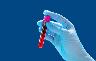 A hand holding a red vial of biomarkers