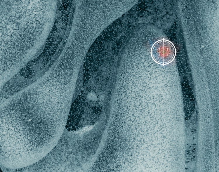 Targeted therapy for breast cancer treatment