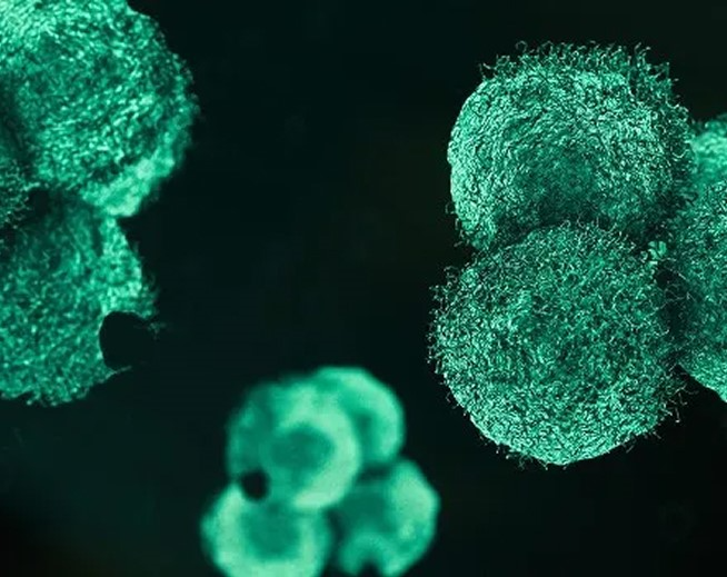 A color-enhanced scanning electron micrograph designed to represent the irregular, textured surface of cancer cells mobile
