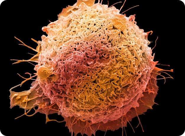 Colorectal cancer cell