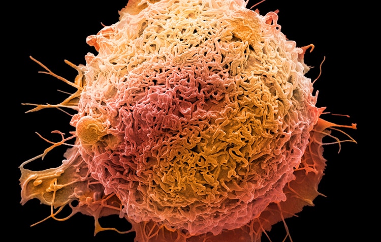 Colorectal cancer cell