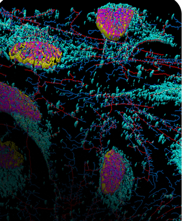 Illustration of colorectal cancer cells