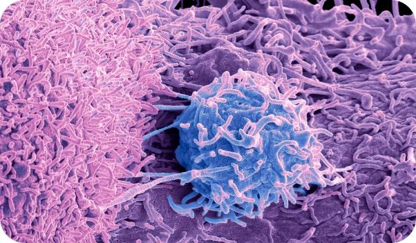Illustration of genitourinary cancer cells